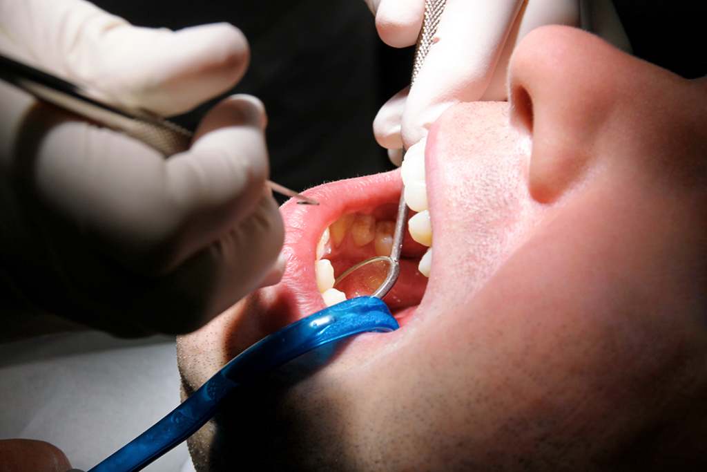 periodontal-maintenance-taking-the-guesswork-out-of-the-4910-today-s-rdh